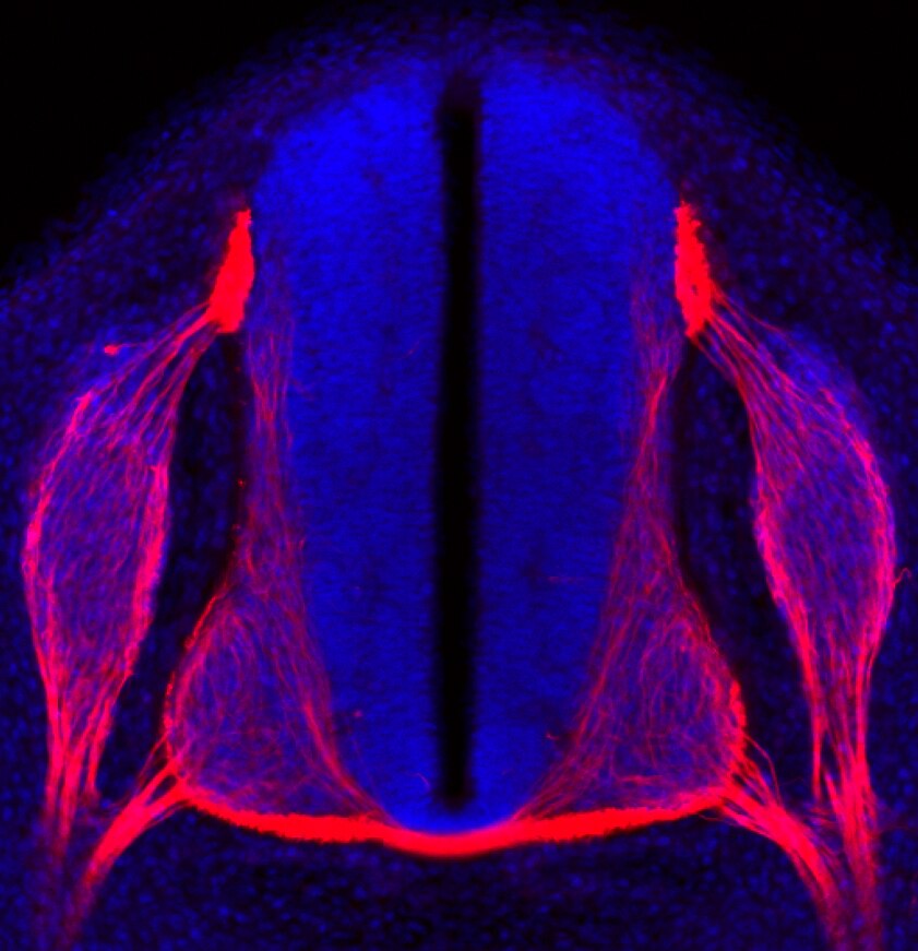 Neurofilament (NF-M) Antibody (2H3) - DSHB